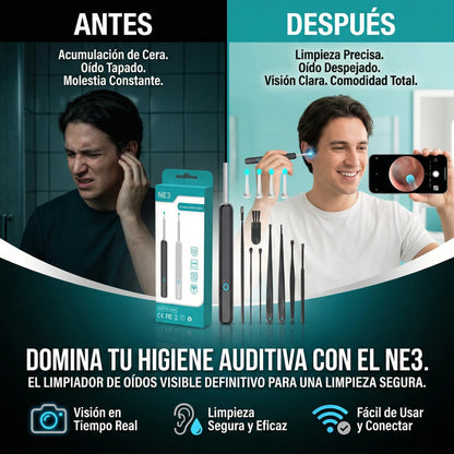 Limpiador Con Camara — Limpiá tus oídos de forma segura y visible