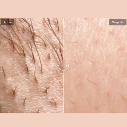 Depiladora IPL– Olvidate del rastrillo, la cera y los pelos encarnados